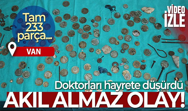Van’da akıl almaz olay! Bunların Hepsi Midesinden çıktı