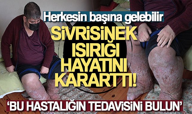 Sivrisinek, güvenlik görevlisinin hayatını kararttı