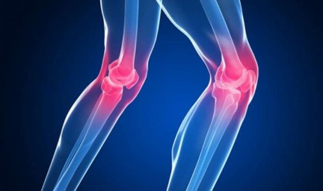 Diz kireçlenmesi yaşıyorsanız...